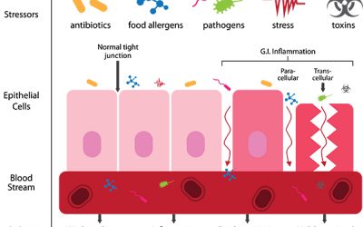 Is There Really Such Thing As Leaky Gut?