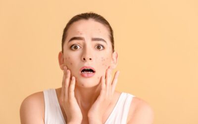 The Gut-Skin Connection: How Your Microbiome Shapes Clear, Healthy Skin